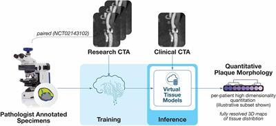 Quantitative imaging biomarkers of coronary plaque morphology: insights from EVAPORATE